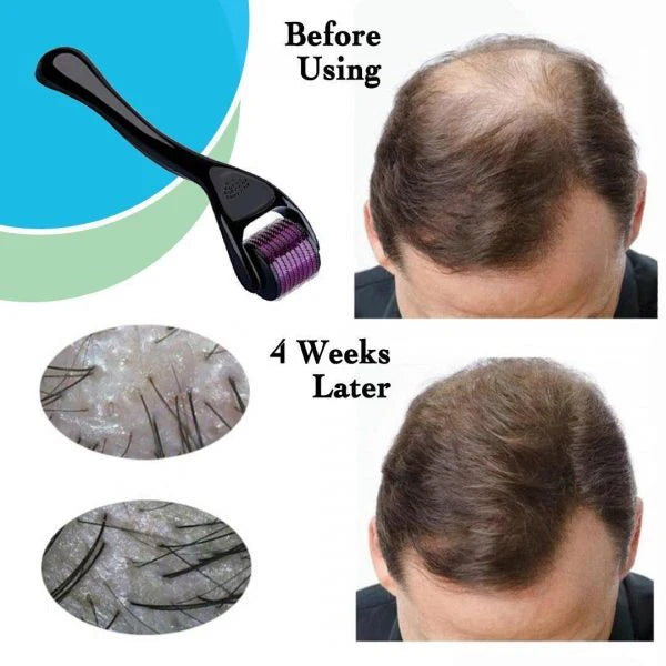 Derma Roller for Hair Growth and Face Wrinkles